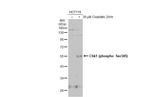 Phospho-CHK1 (Ser345) Antibody in Western Blot (WB)