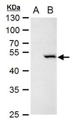 Chk1 Antibody in Western Blot (WB)