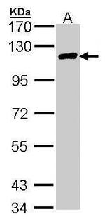 CYLD Antibody in Western Blot (WB)