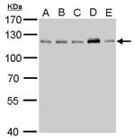 CYLD Antibody in Western Blot (WB)