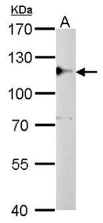 CYLD Antibody in Western Blot (WB)