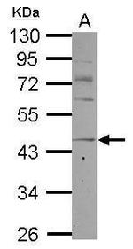 CCR8 Antibody in Western Blot (WB)