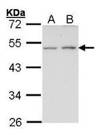 Endothelin B Receptor Antibody in Western Blot (WB)