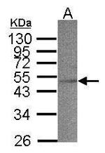 ACADS Antibody in Western Blot (WB)