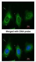 Periostin Antibody in Immunocytochemistry (ICC/IF)