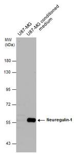 NRG1 Antibody in Western Blot (WB)