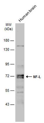 NEFL Antibody in Western Blot (WB)