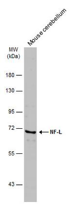 NEFL Antibody in Western Blot (WB)