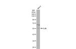 LCK Antibody in Western Blot (WB)