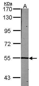 LCK Antibody in Western Blot (WB)