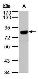 Amyloid Precursor Protein Antibody in Western Blot (WB)