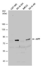 Amyloid Precursor Protein Antibody in Western Blot (WB)