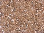 Axl Antibody in Immunohistochemistry (Paraffin) (IHC (P))