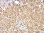 Aldolase B Antibody in Immunohistochemistry (Paraffin) (IHC (P))