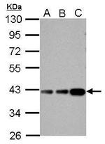 Aldolase B Antibody in Western Blot (WB)