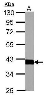 Aldolase B Antibody in Western Blot (WB)