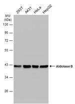 Aldolase B Antibody in Western Blot (WB)