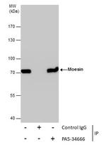 Moesin Antibody in Immunoprecipitation (IP)