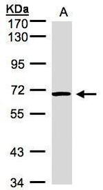 ACVRL1 Antibody in Western Blot (WB)