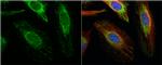 ACAT1 Antibody in Immunocytochemistry (ICC/IF)