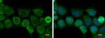 ACAT1 Antibody in Immunocytochemistry (ICC/IF)