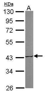 ACAT1 Antibody in Western Blot (WB)