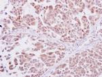 POLD1 Antibody in Immunohistochemistry (Paraffin) (IHC (P))