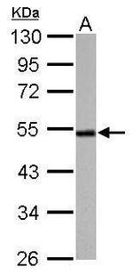 Cyclin A2 Antibody in Western Blot (WB)