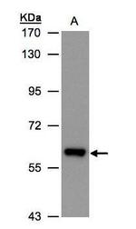 ALDH6A1 Antibody in Western Blot (WB)