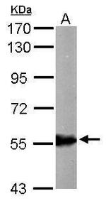 ALDH6A1 Antibody in Western Blot (WB)