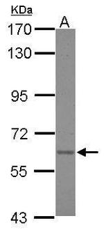 Asparagine Synthetase Antibody in Western Blot (WB)