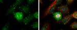 Aurora A Antibody in Immunocytochemistry (ICC/IF)