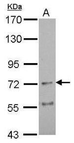 CHRNA4 Antibody in Western Blot (WB)