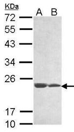 C11orf85 Antibody in Western Blot (WB)