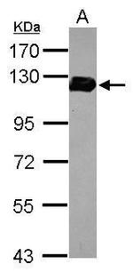 Drebrin Antibody in Western Blot (WB)