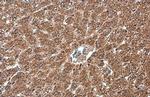 NFkB p65 Antibody in Immunohistochemistry (Paraffin) (IHC (P))