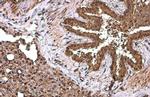 NFkB p65 Antibody in Immunohistochemistry (Paraffin) (IHC (P))