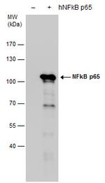 NFkB p65 Antibody in Western Blot (WB)