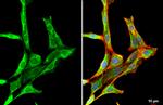 PDGFRA Antibody in Immunocytochemistry (ICC/IF)