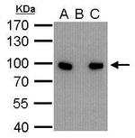 Calnexin Antibody in Immunoprecipitation (IP)