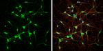 NF-H Antibody in Immunocytochemistry (ICC/IF)