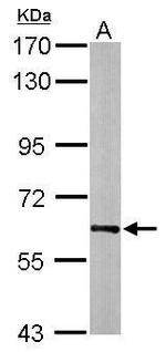 HSP60 Antibody in Western Blot (WB)