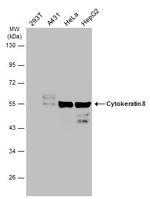 Cytokeratin 8 Antibody in Western Blot (WB)