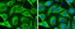 Cytokeratin 8 Antibody in Immunocytochemistry (ICC/IF)