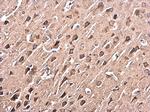 p38 MAPK alpha Antibody in Immunohistochemistry (Paraffin) (IHC (P))