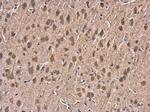 HSPA1A Antibody in Immunohistochemistry (Paraffin) (IHC (P))