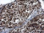 PRP19 Antibody in Immunohistochemistry (Paraffin) (IHC (P))