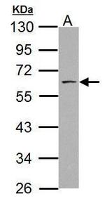 ABI1 Antibody in Western Blot (WB)