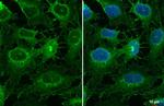 Collagen III Antibody in Immunocytochemistry (ICC/IF)