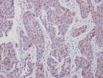 CDK7 Antibody in Immunohistochemistry (Paraffin) (IHC (P))